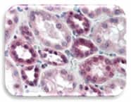 IHC Image of DAXX