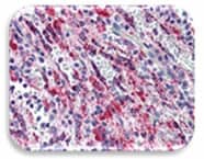IHC Image of TGF beta 1
