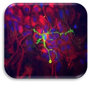 Coronin 1A Antibody