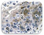 IHC Image of IL1 beta