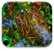 GFAP Antibody
