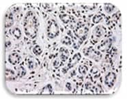 IHC Image of SAPK3