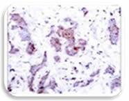 IHC Image of c-Rel