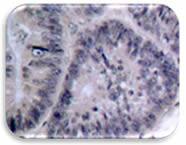 IHC Image of IKK alpha