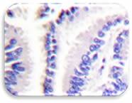 IHC Image of FADD