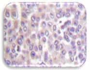 IHC Image of cPLA2
