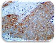 IHC Image of TGF beta 1