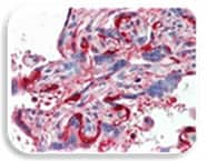 IHC Image of p38