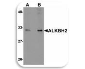 WB Image of ALKBH2