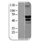 Beclin 1 Lysate