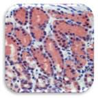 IHC Image of Caspase 8