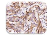 IHC Image of Cytokeratin 19