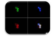 IF Image of Cytokeratin 19