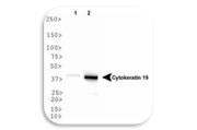 WB Image of Cytokeratin 19