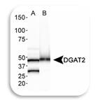 WB Image of DGAT2