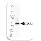 WB Image of DGAT2