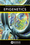 epigenetics