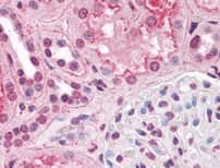 IHC Image of HIF-1 alpha