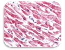 IHC Image of HIF-2 alpha