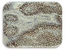 IHC Image of HIF-1 beta