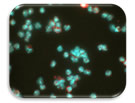 IF Image of HIF-1 alpha