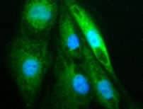 ICC Image of HIF-1 alpha