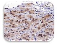 IHC Image of Hsp70