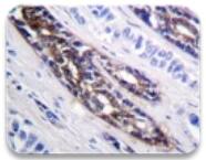IHC Image of IRAK