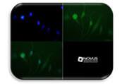 IF Image of JHDM2A