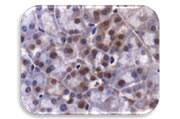 IHC Image of JMJD2A