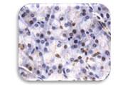 IHC image of JMJD2C