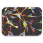 IF Image of Laminin