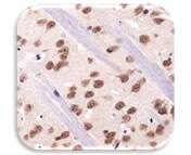 IHC Image of RBFOX3