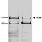 WB Image of PARP