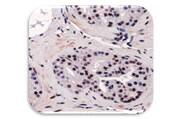IHC Image of RUNX2