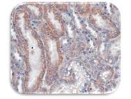IHC Image of VLDL Receptor