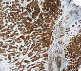 IHC image of Fit-3