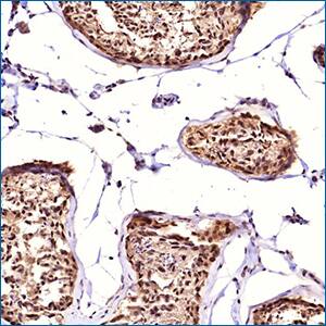 Novus ALKBH5 Antibody New rabbit polyclonal ALKBH5 primary antibody from Novus Biologicals.