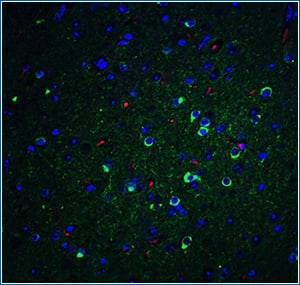 ApoE expression in mouse brain tissue IHC