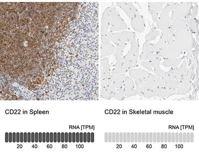 CD22 expression in spleen and skeletal muscle, IHC