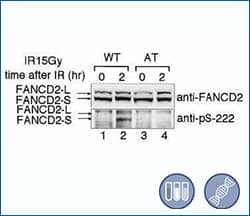 FANCD2 [p Ser222] in irradiated lymphoblasts, WB