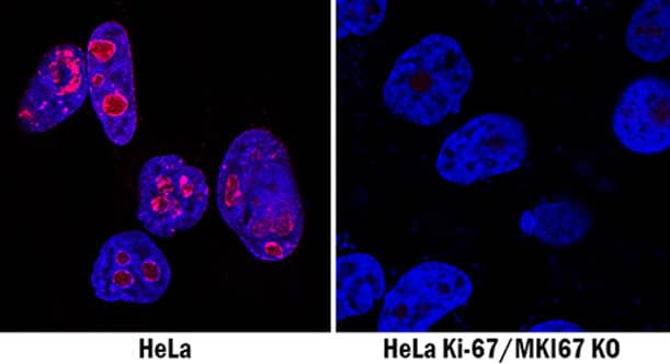 HeLa cells and Ki-67 Knockout (KO) HeLa cells were stained with anti-human Ki-67 antibody