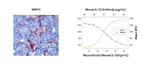 (Left) IHC image showing MMP-9 staining in red in human prostate cancer. (Right) Graph showing increased proliferation of MC/9-2 cell line with increasing concentration of IL-2 (orange line) and increasing concentration of IL-10 antibody leads to decreased proliferation of MC/9-2 (green). 