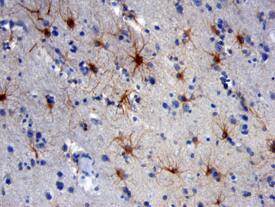 NCAM-1/CD56 expression in human brain, IHC