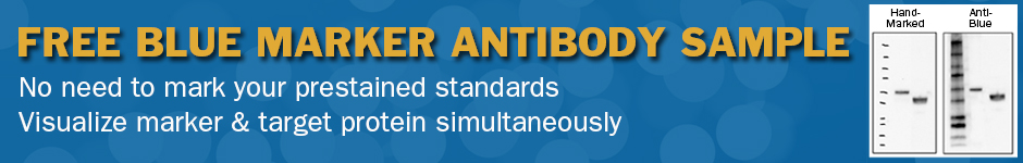 Epitope Tags Research Area of the Month