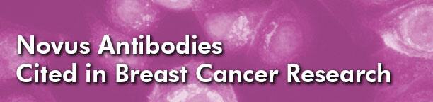 Novus Antibodies Cited in Breast Cancer Research