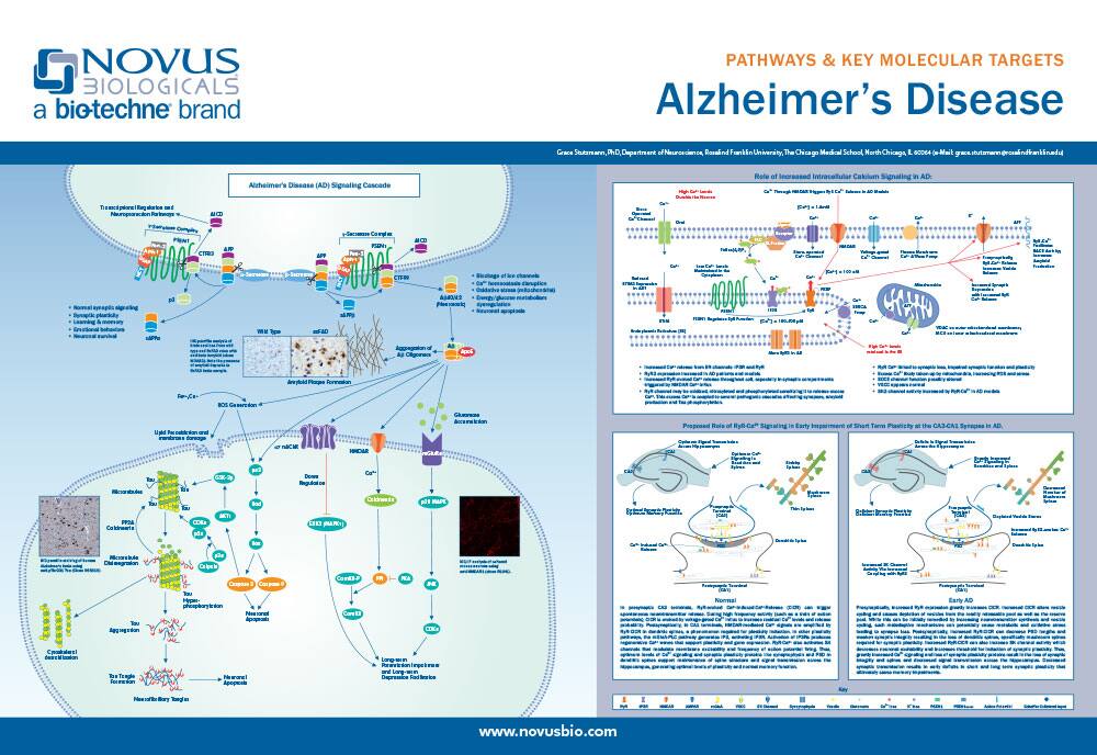 Alzheimer’s Disease Poster