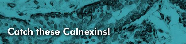 Catch the Calnexins!