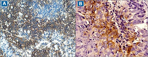 Carbonic anhydrase IX/CA9 expression serves as a marker for hypoxia. Expression of Carbonic anhydrase IX/CA9 is regulated by HIFs and is commonly increased in cancer tissues (e.g., colon and breast carcinoma)