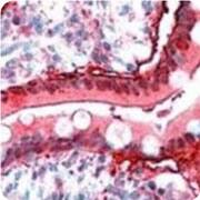 connexin 26/gbj2